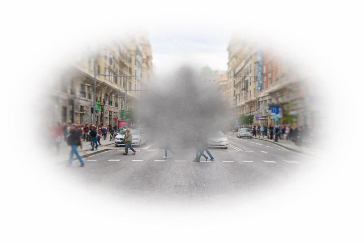 Simulació de la visió amb Malaltia de Stargardt: pèrdua de la zona central amb taca fosca al camp visual.